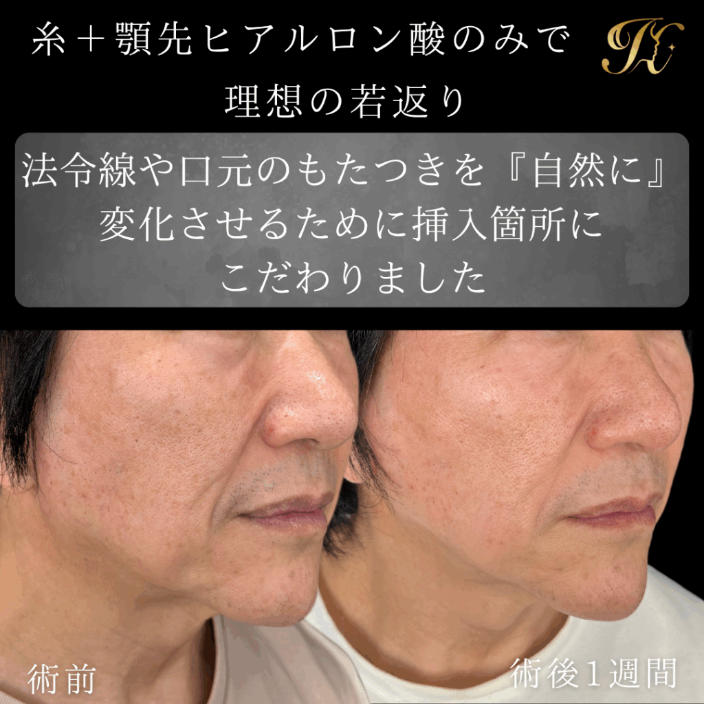 症例イメージ