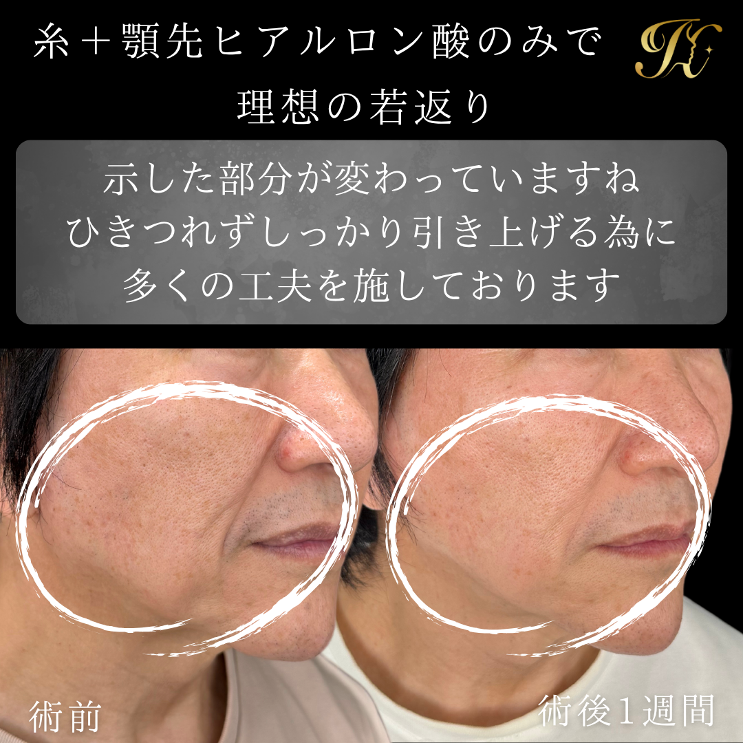 症例イメージ