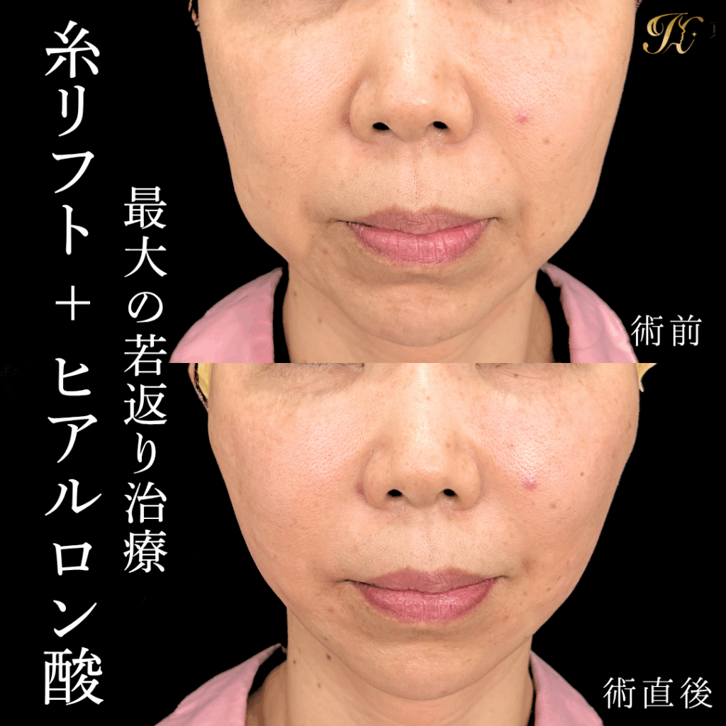 症例イメージ