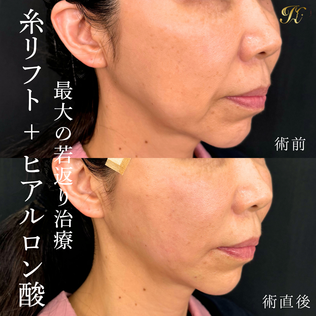 症例イメージ