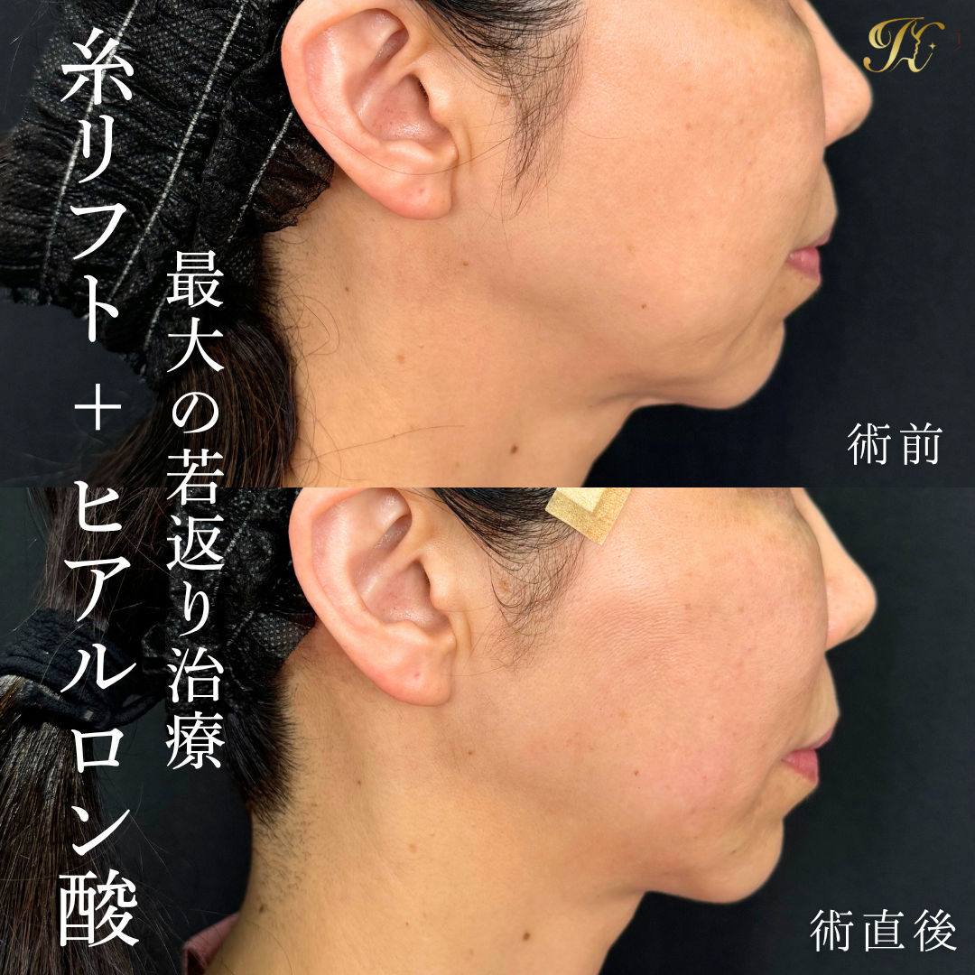 症例イメージ