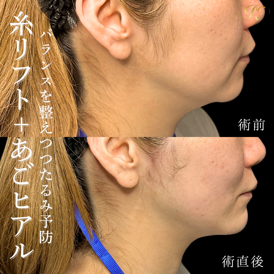 症例イメージ