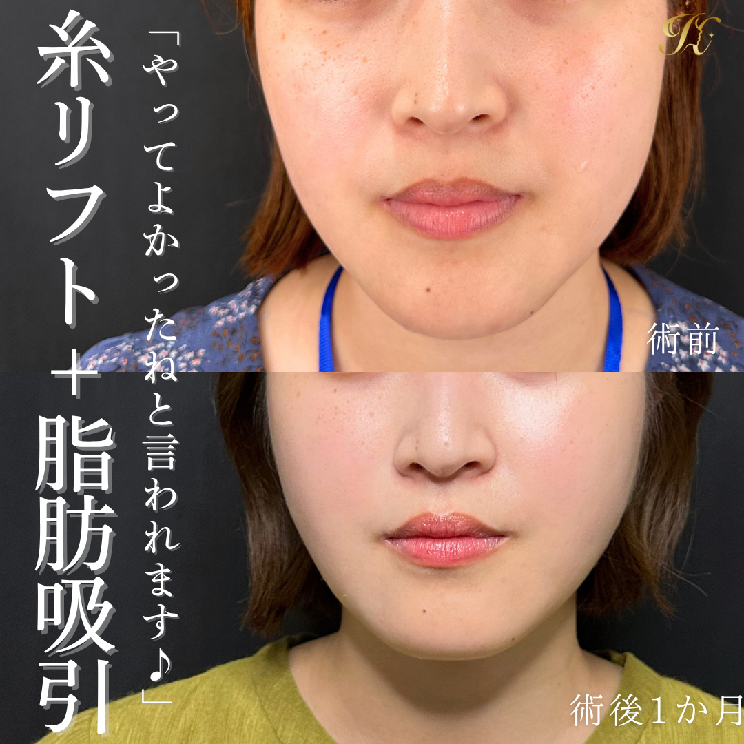 症例イメージ