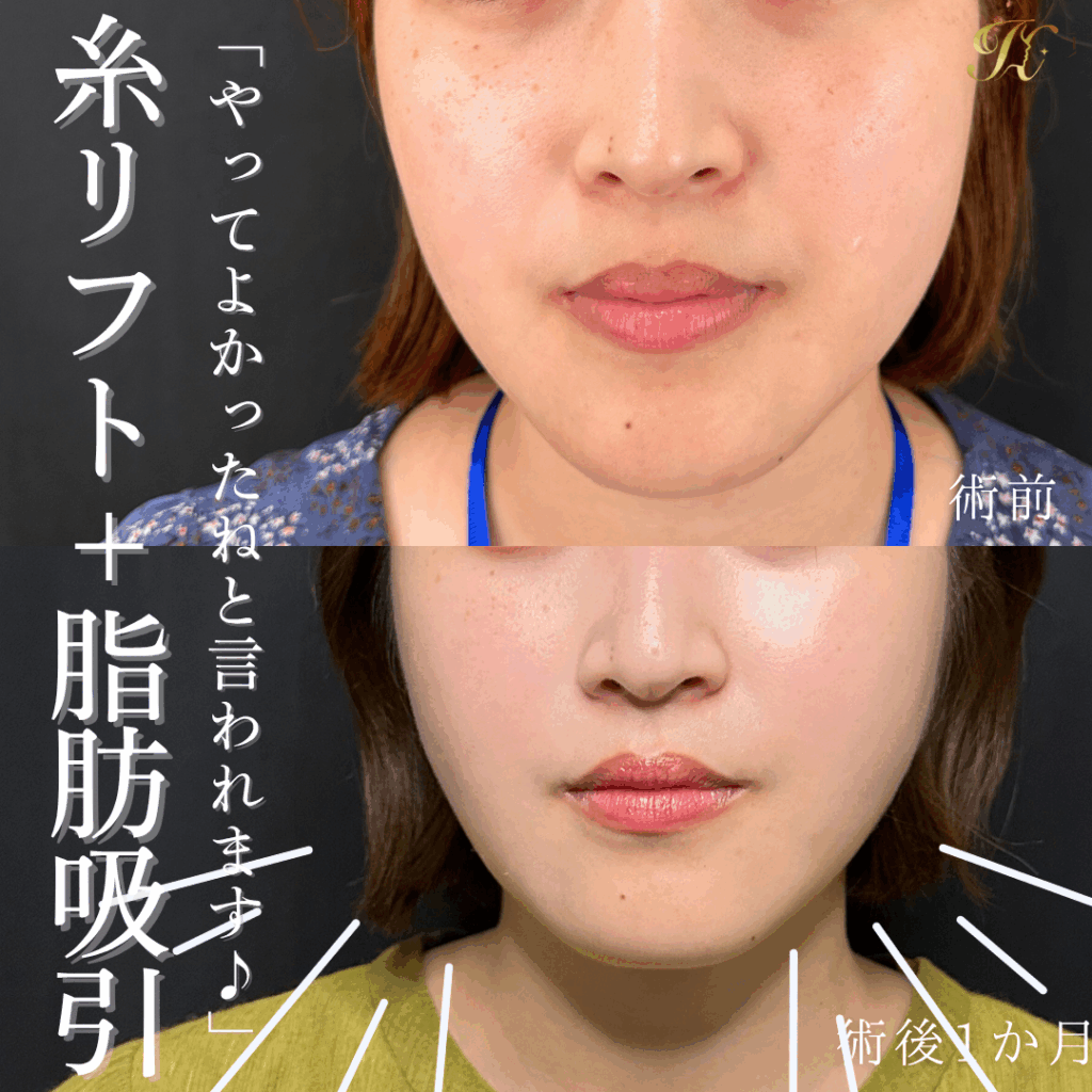 症例イメージ