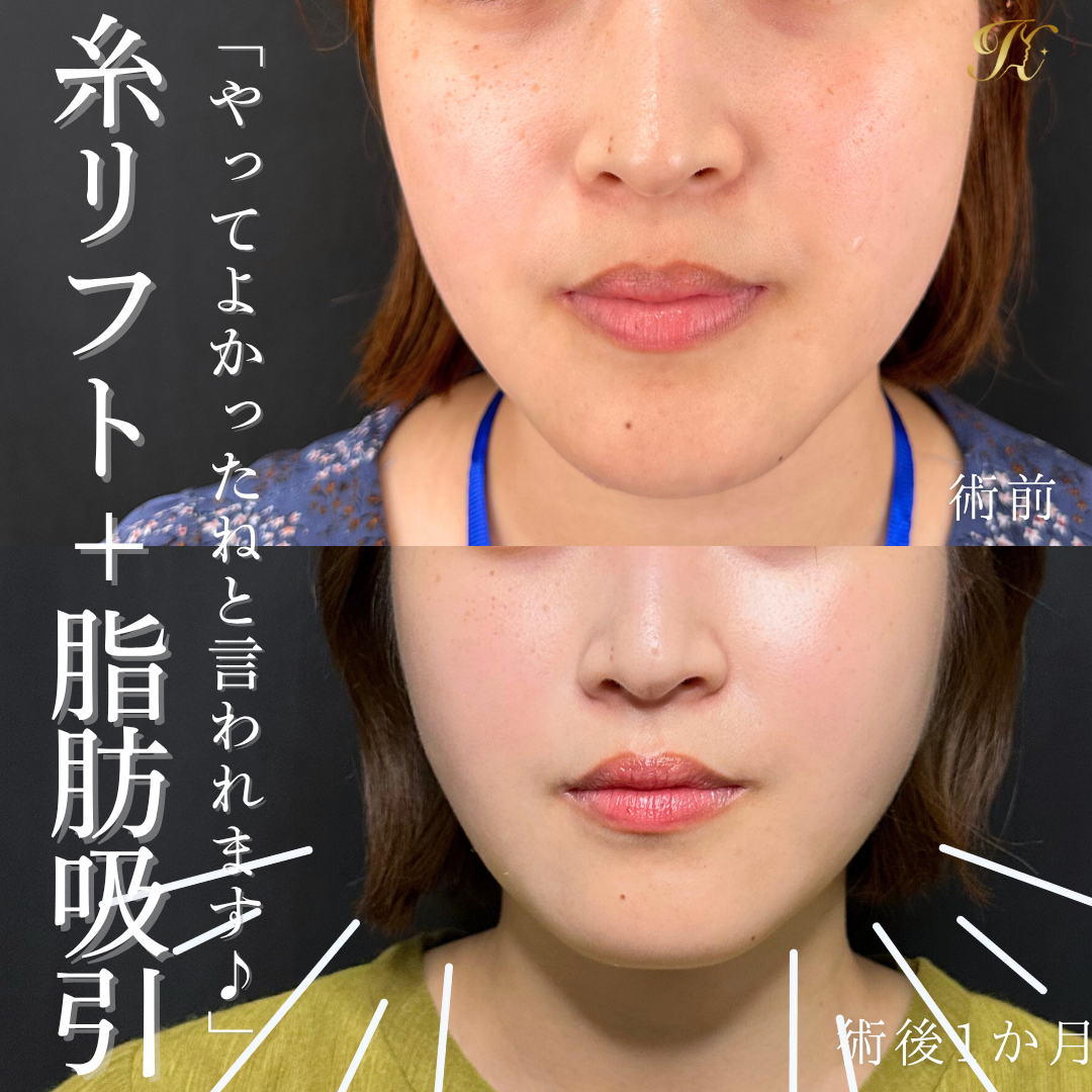 症例イメージ