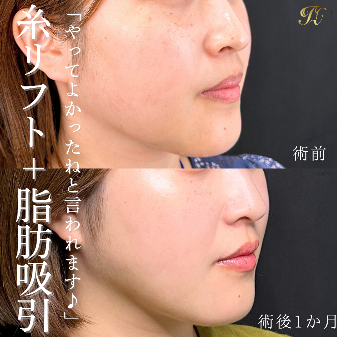 症例イメージ