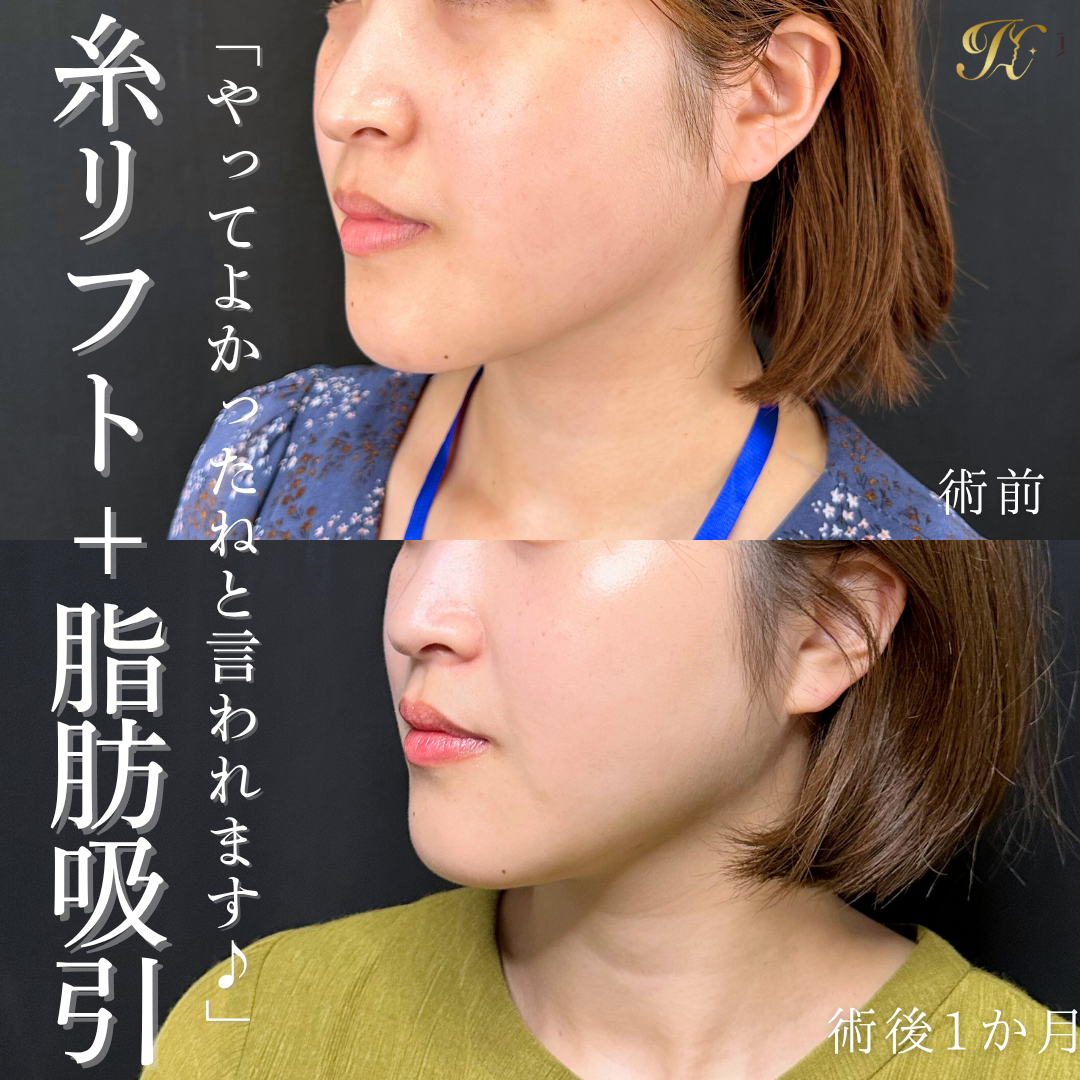 症例イメージ