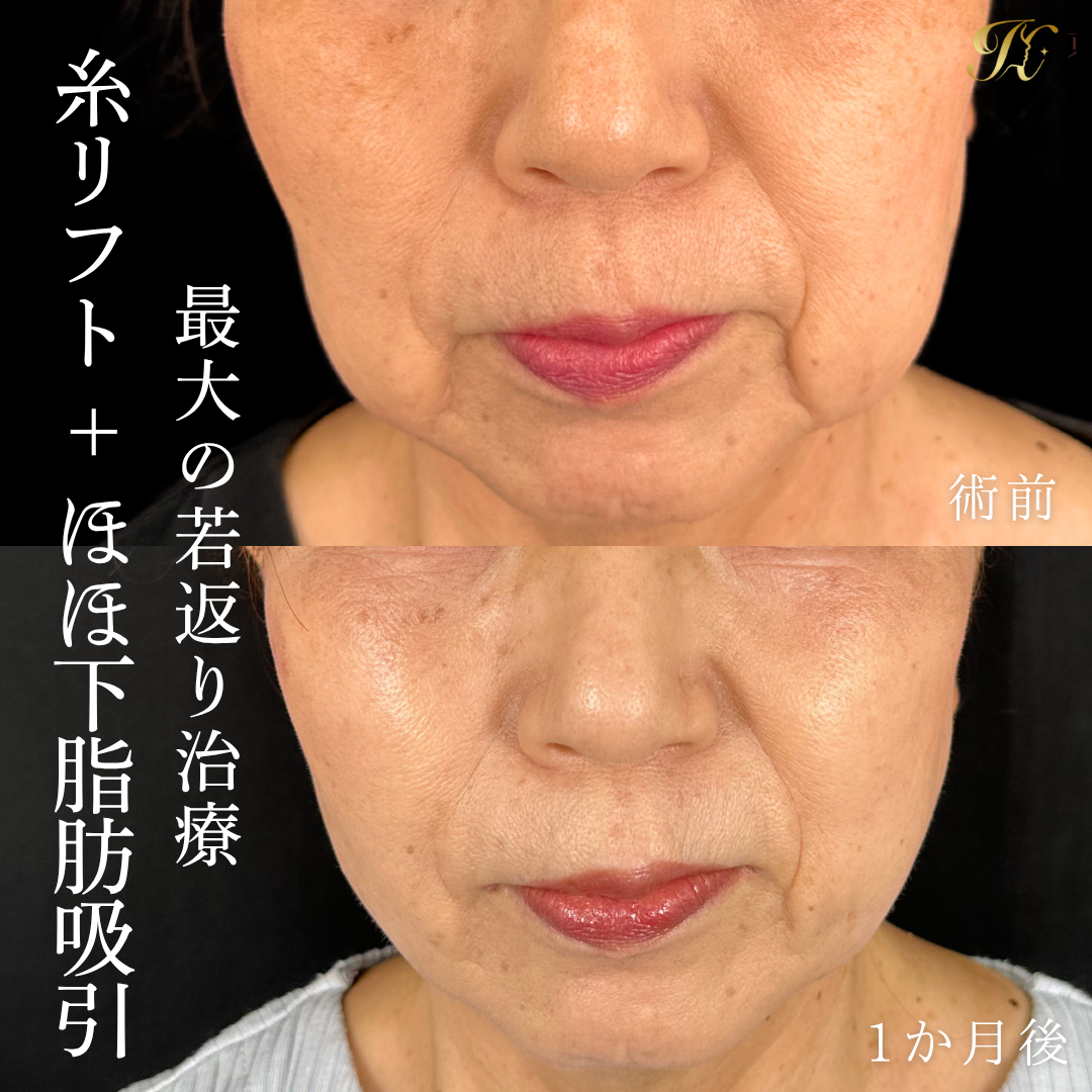 症例イメージ