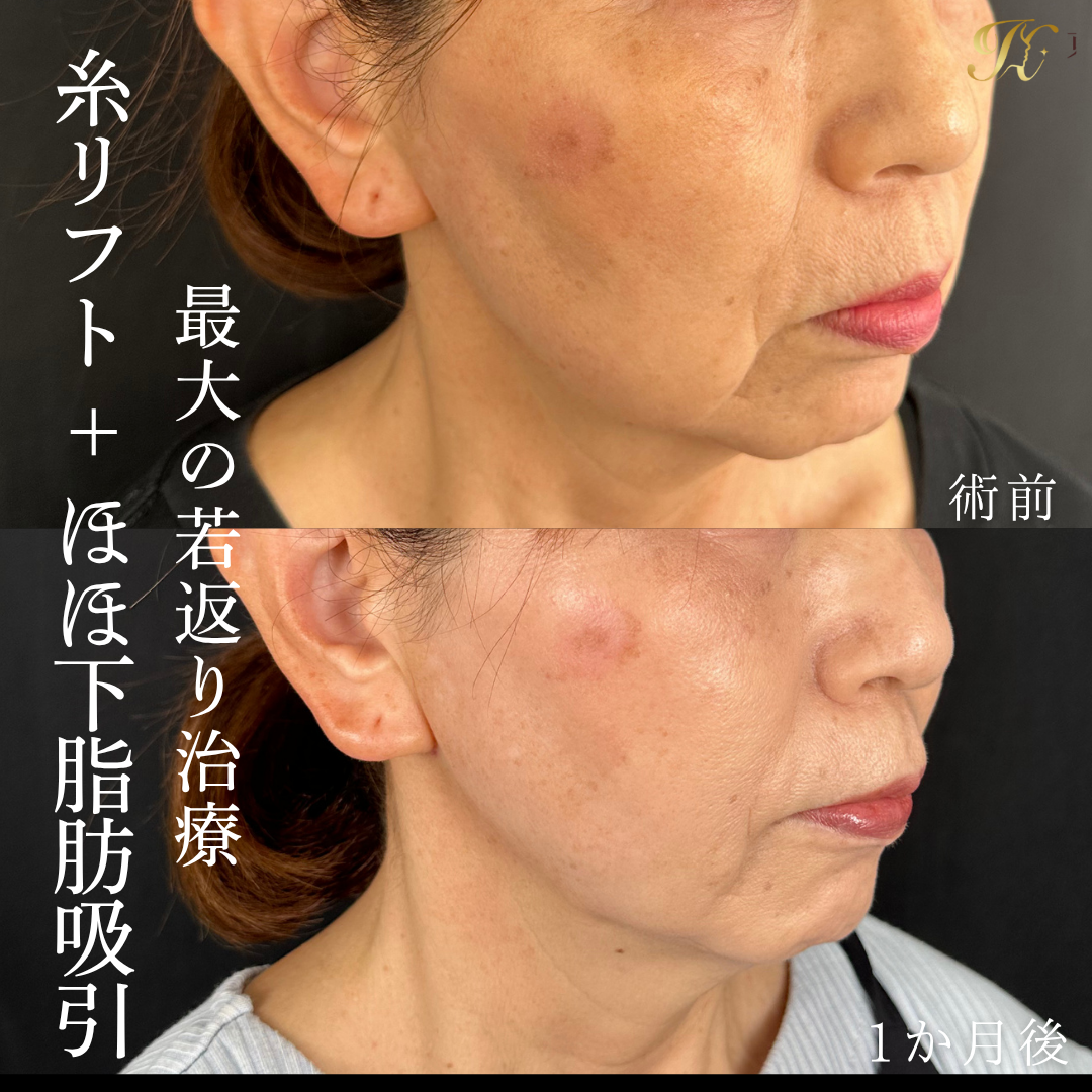 症例イメージ