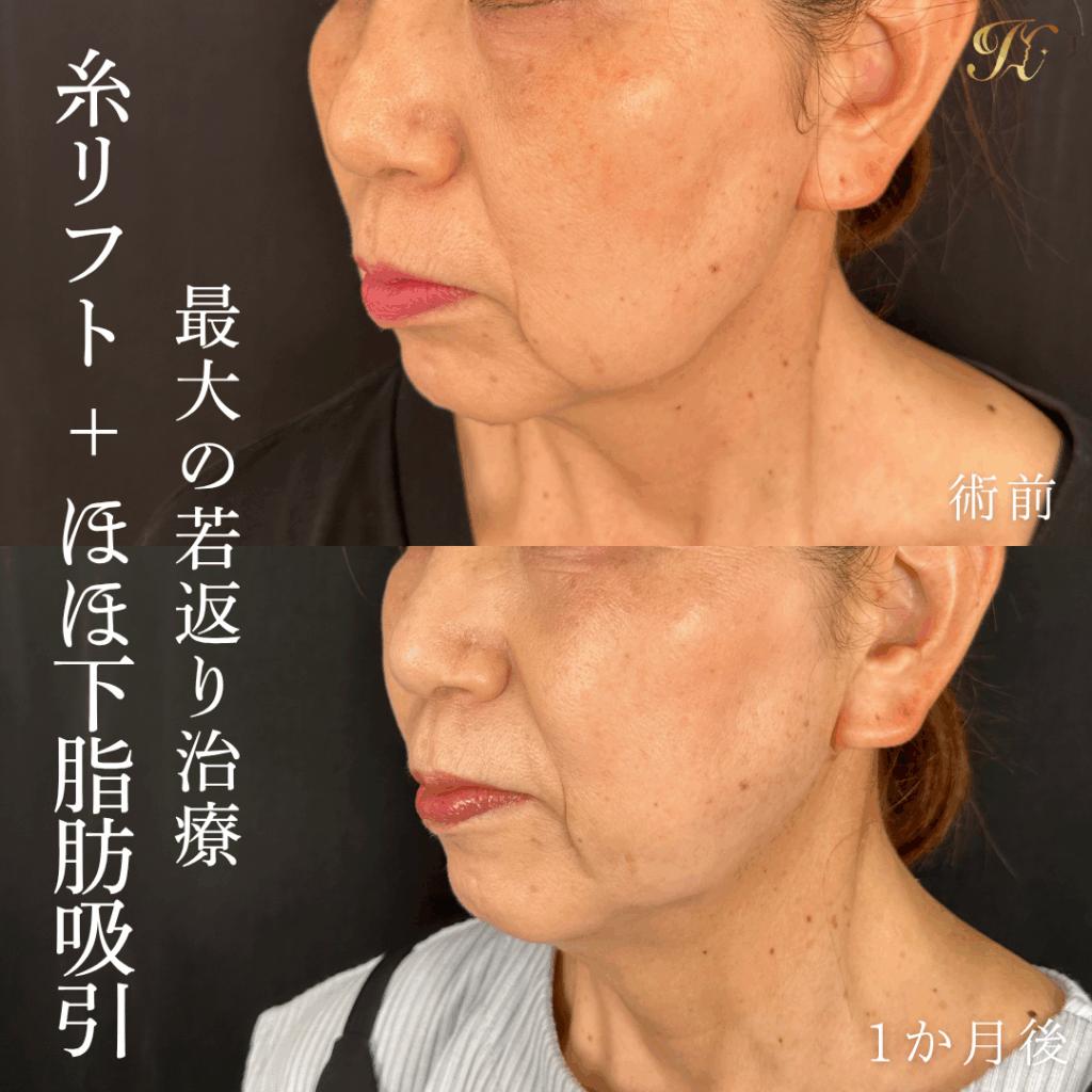 症例イメージ
