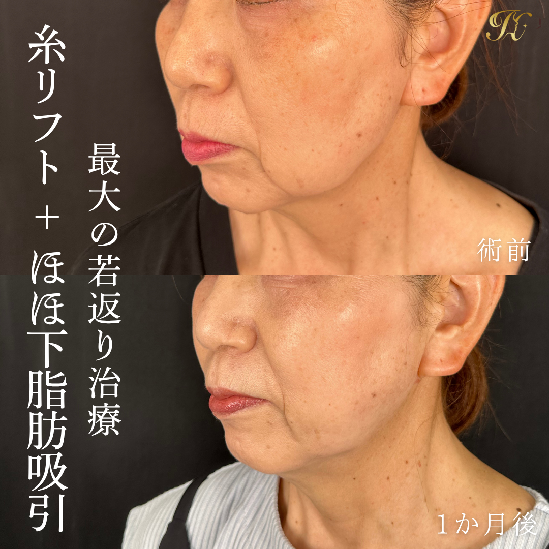 症例イメージ