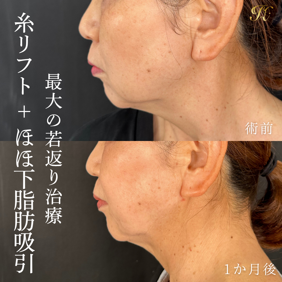 症例イメージ