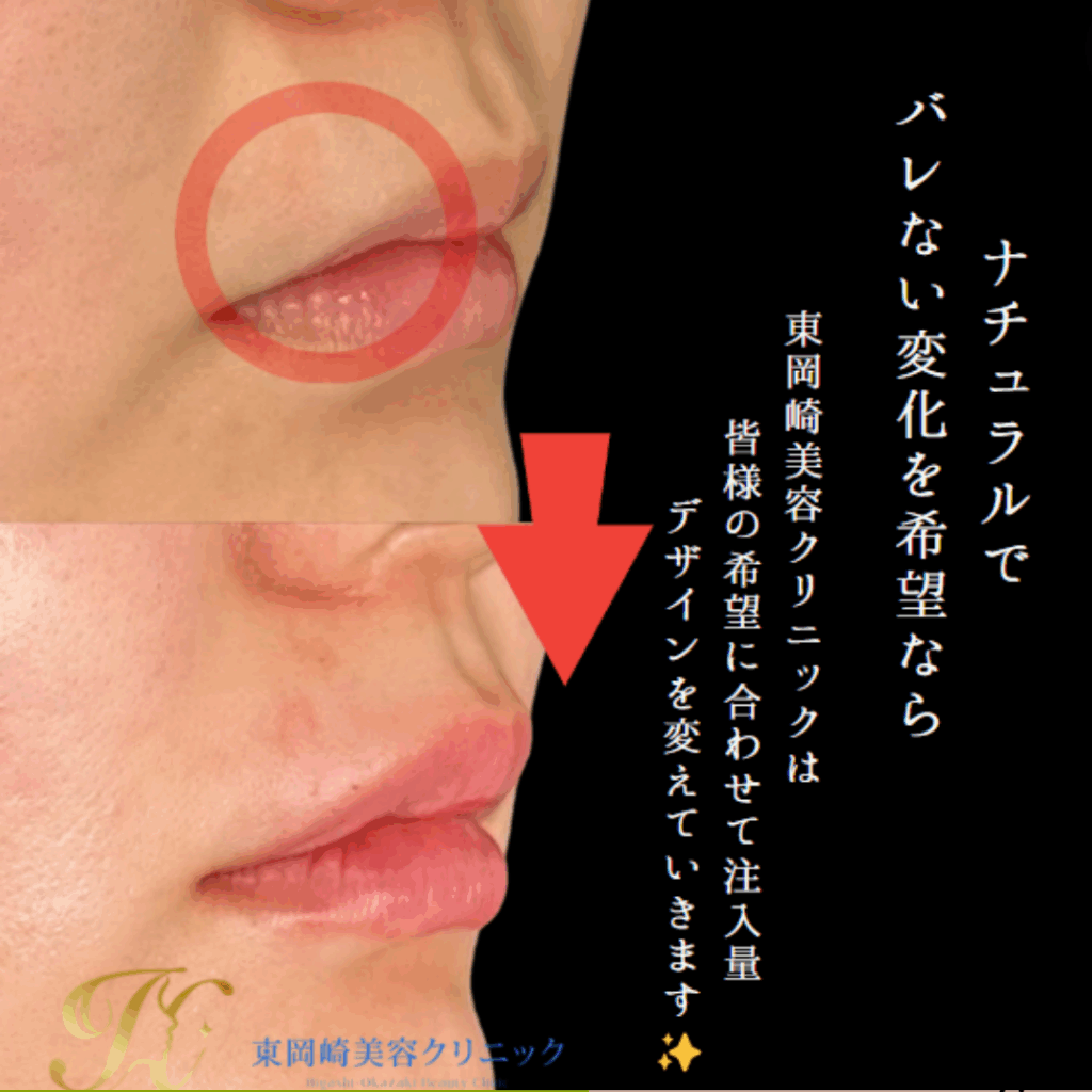 症例イメージ