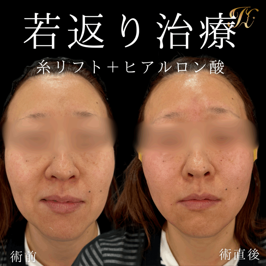 症例イメージ