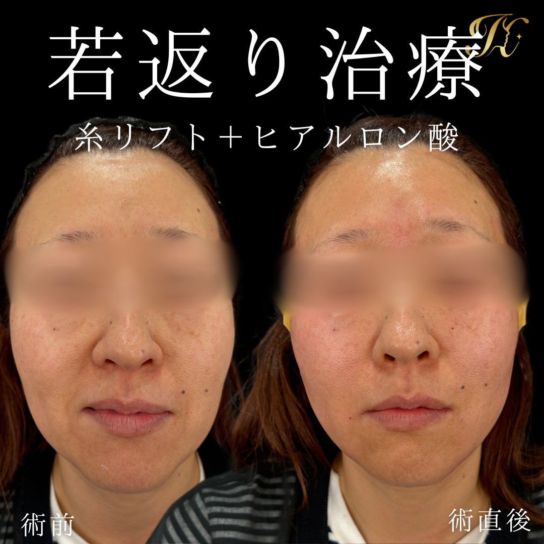 症例イメージ