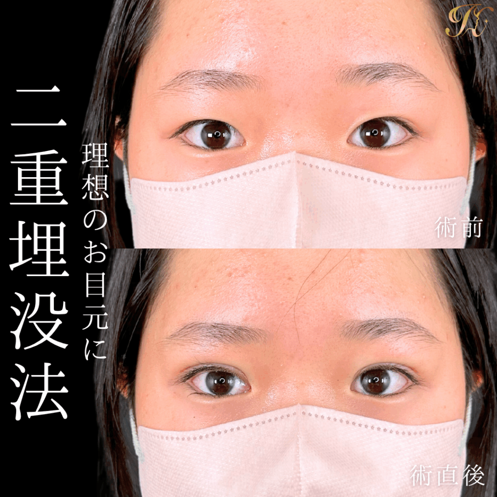 症例イメージ