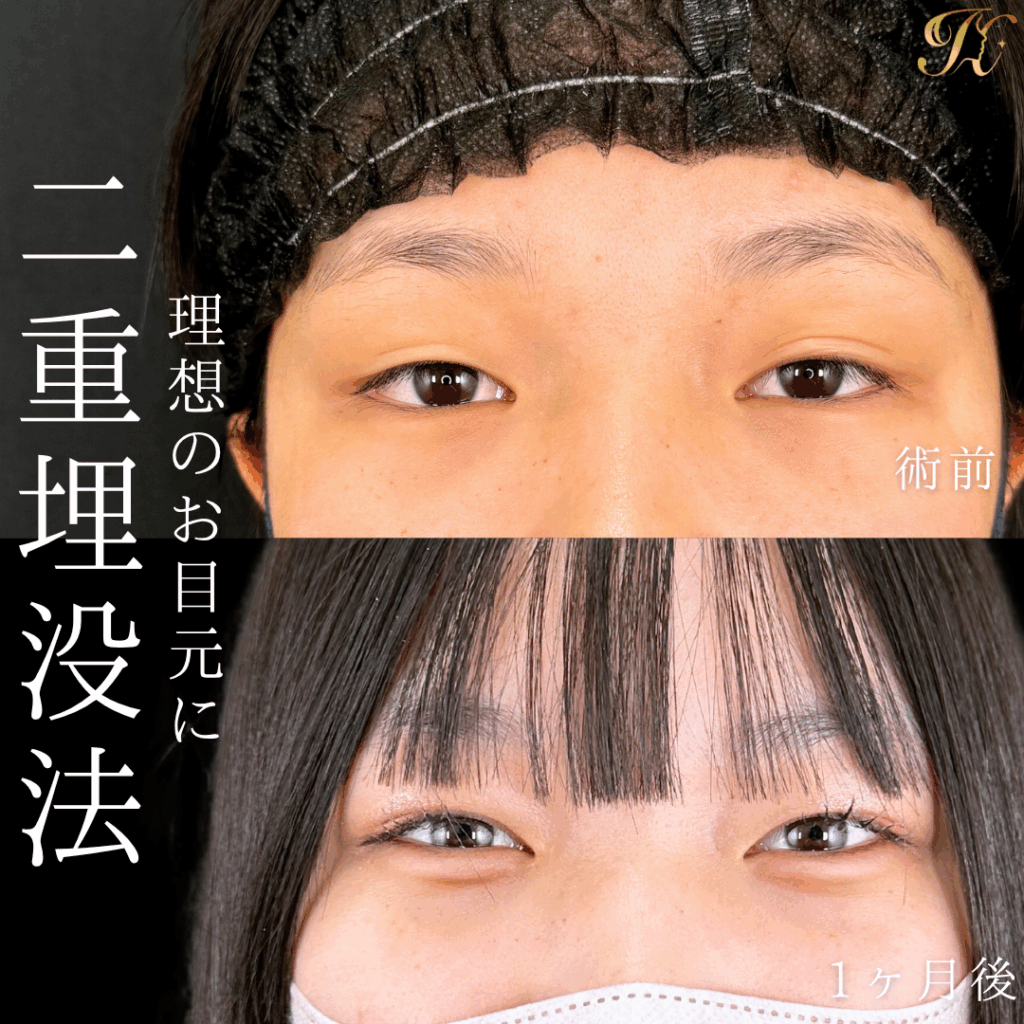 症例イメージ