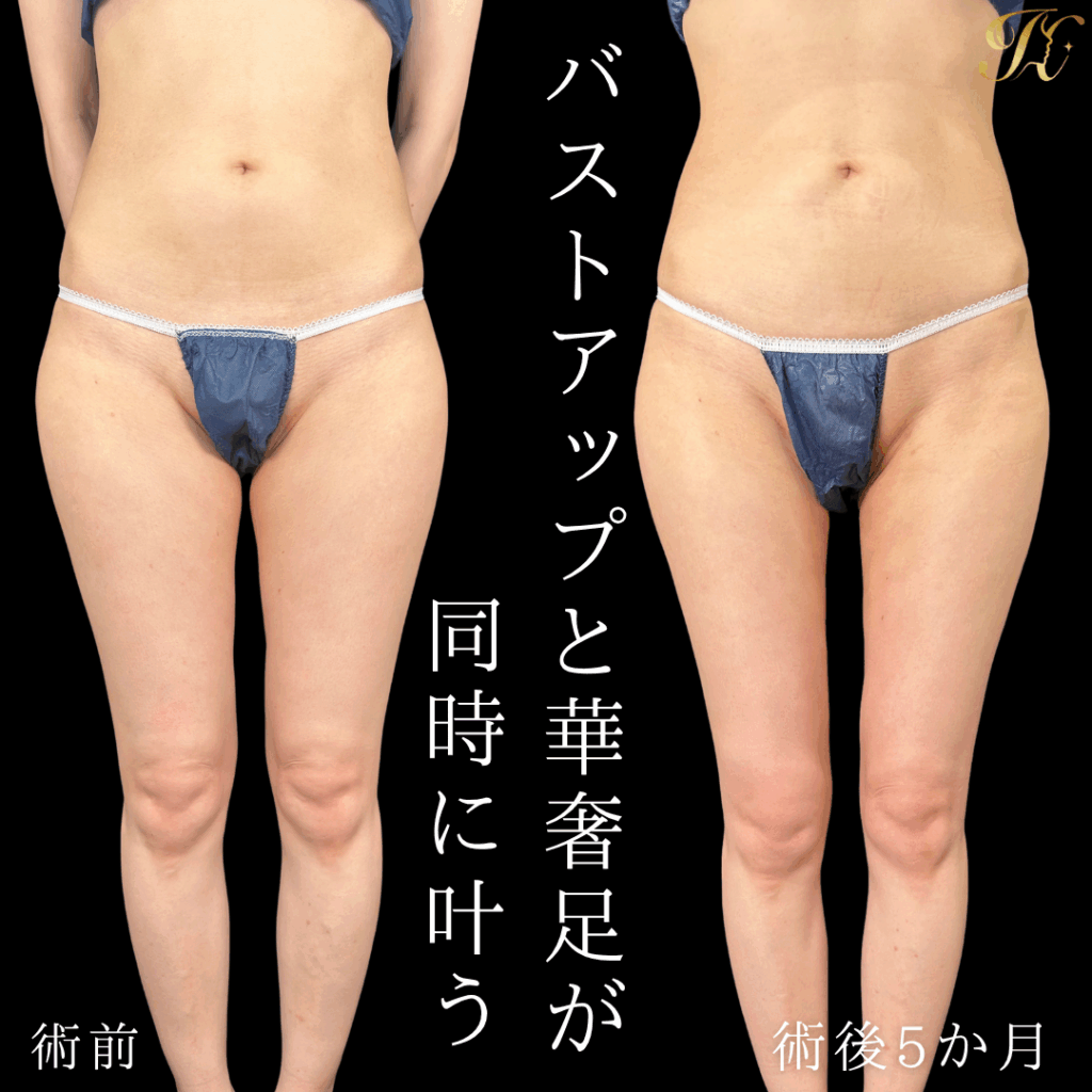 症例イメージ