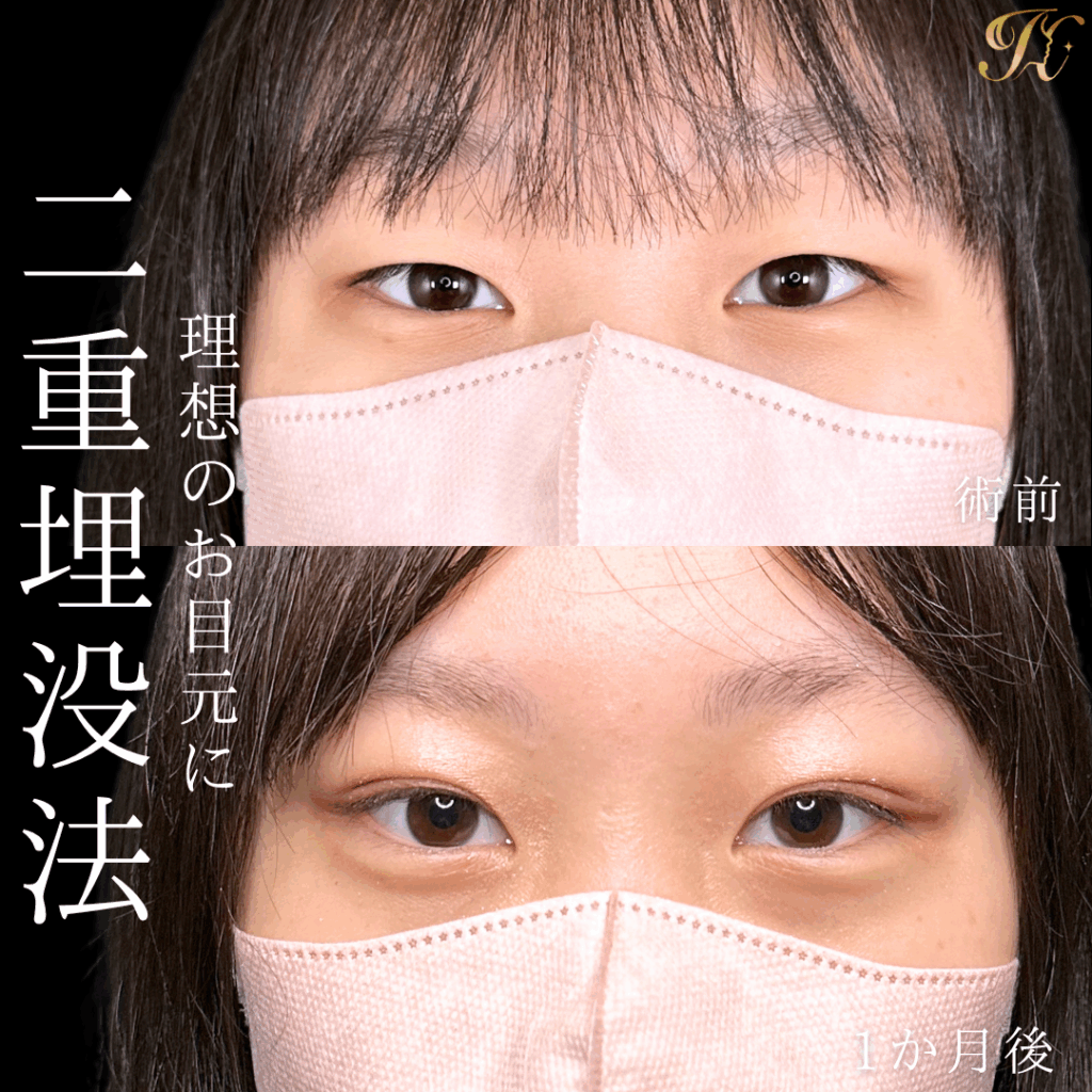 症例イメージ