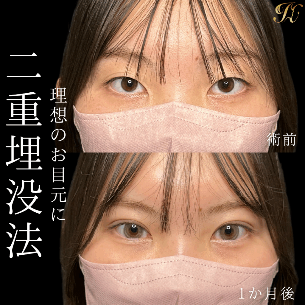 症例イメージ