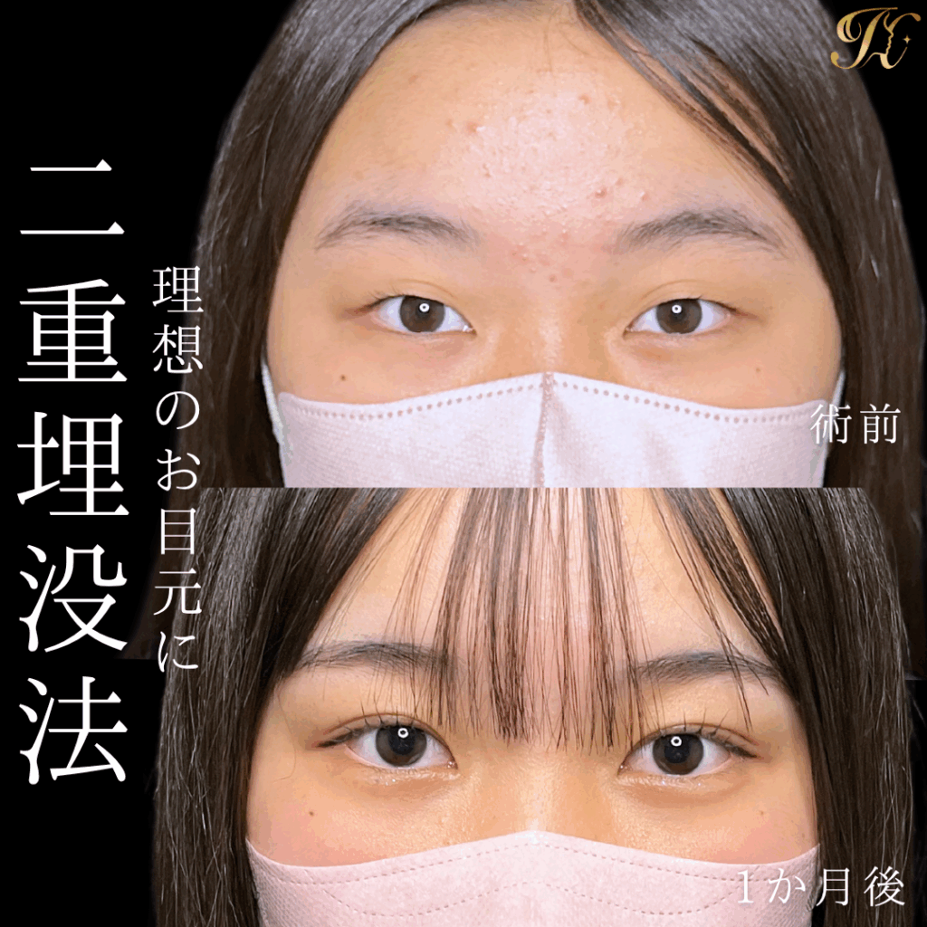 症例イメージ