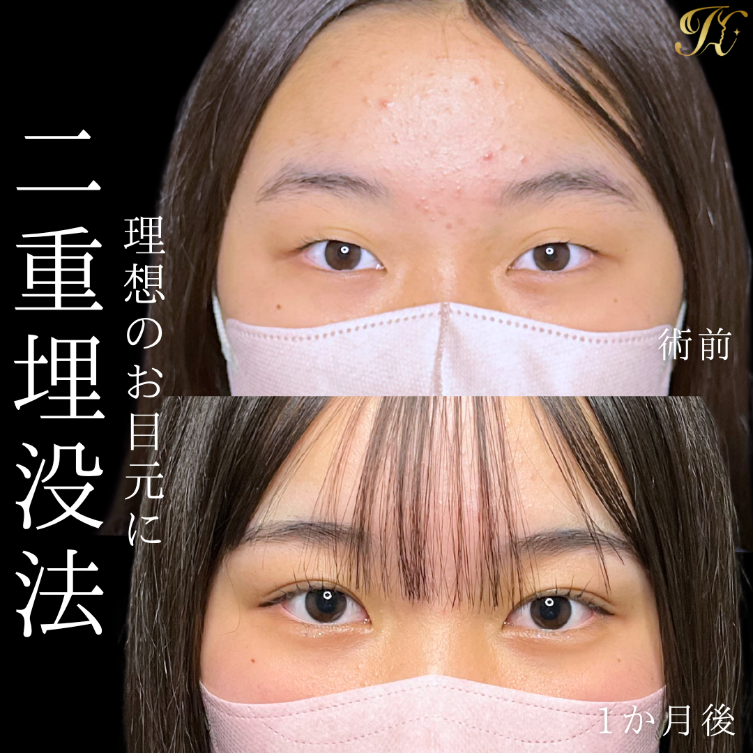 症例イメージ