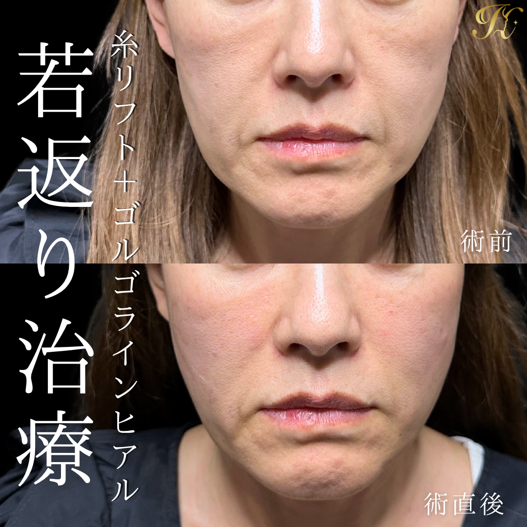 症例イメージ