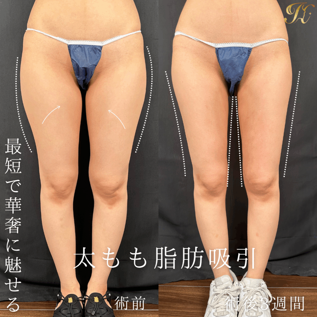 症例イメージ