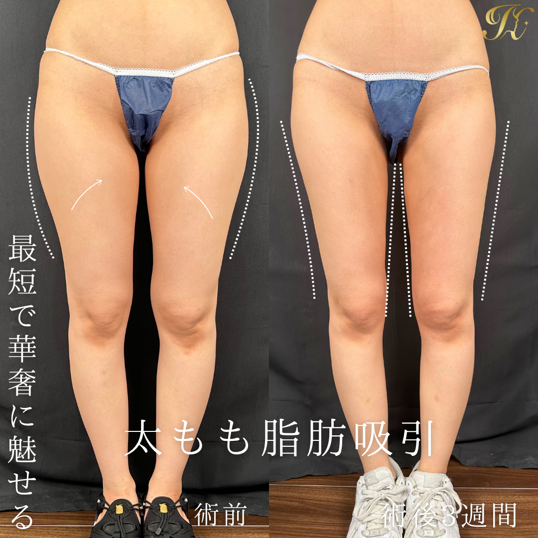 症例イメージ