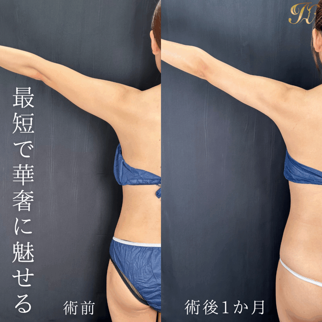 症例イメージ