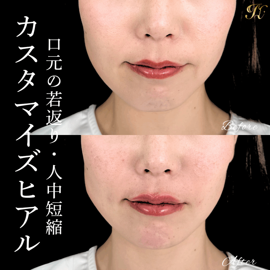症例イメージ