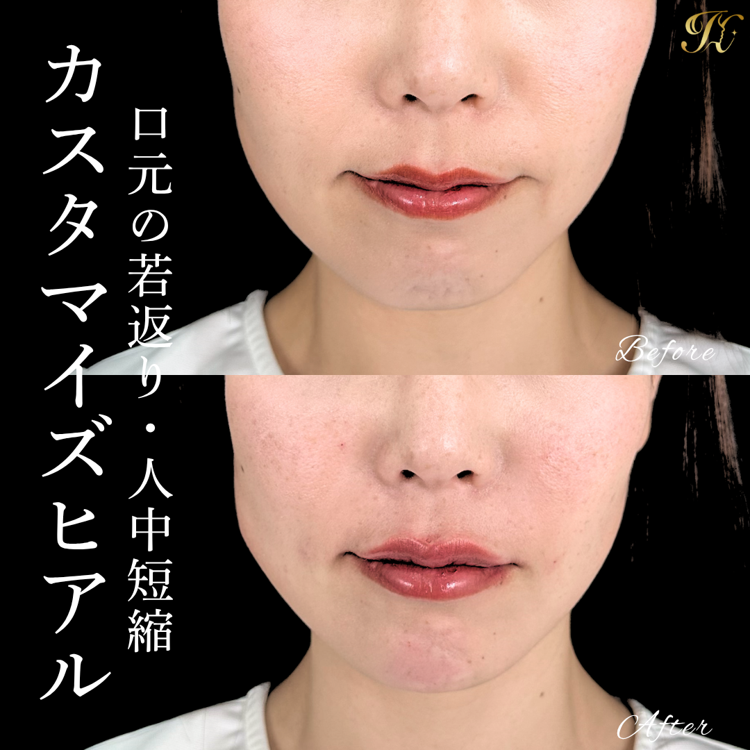 症例イメージ