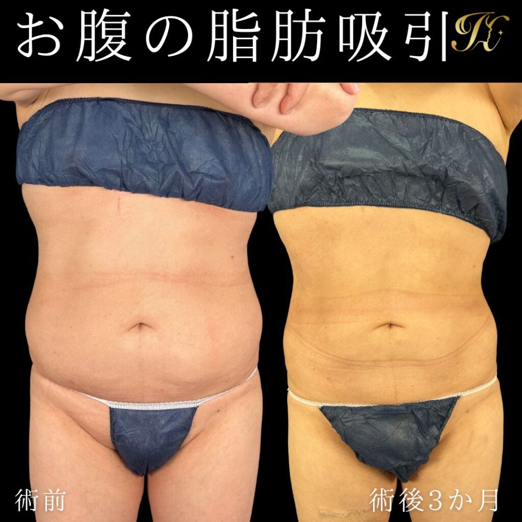症例イメージ