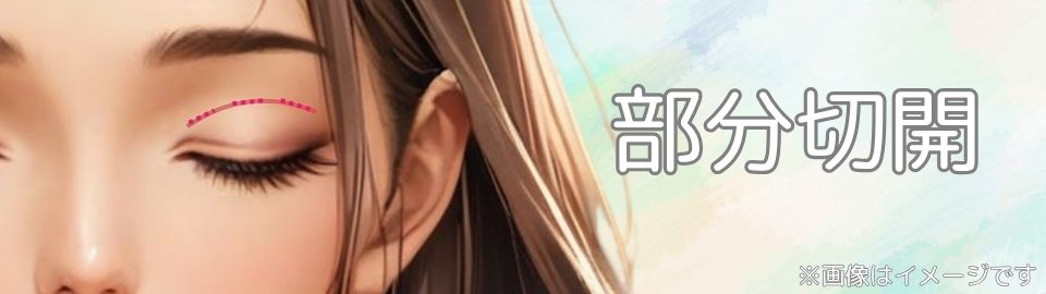 二重整形の部分切開イメージ画像