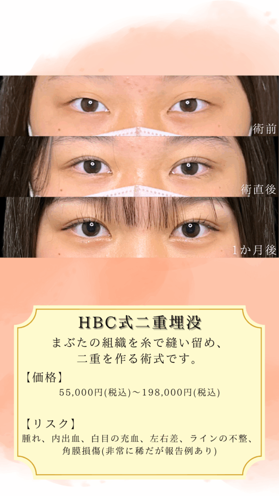 症例イメージ