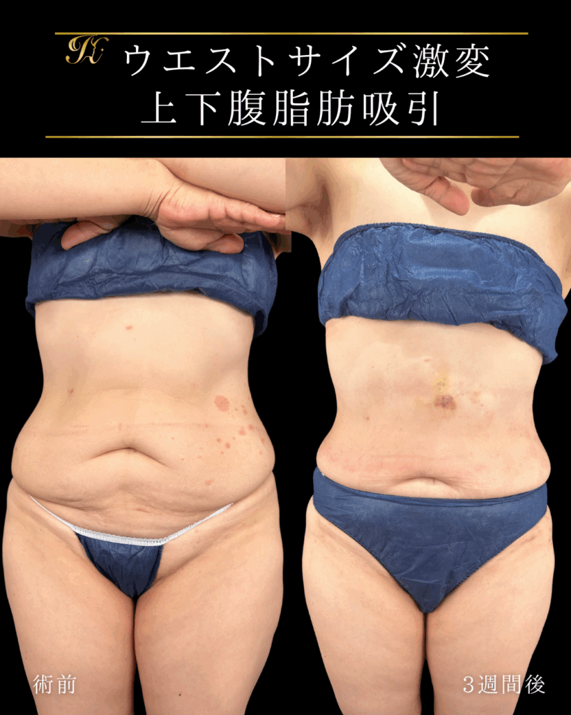 症例イメージ