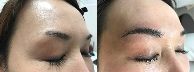 銀座よしえクリニックアートメイク症例写真