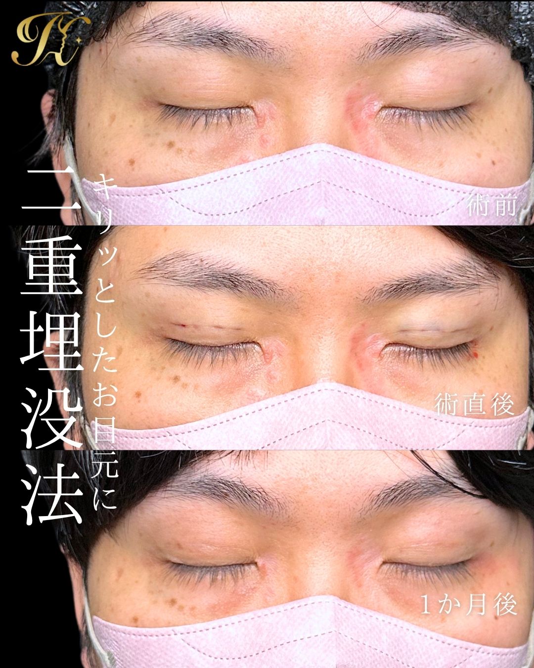 症例イメージ
