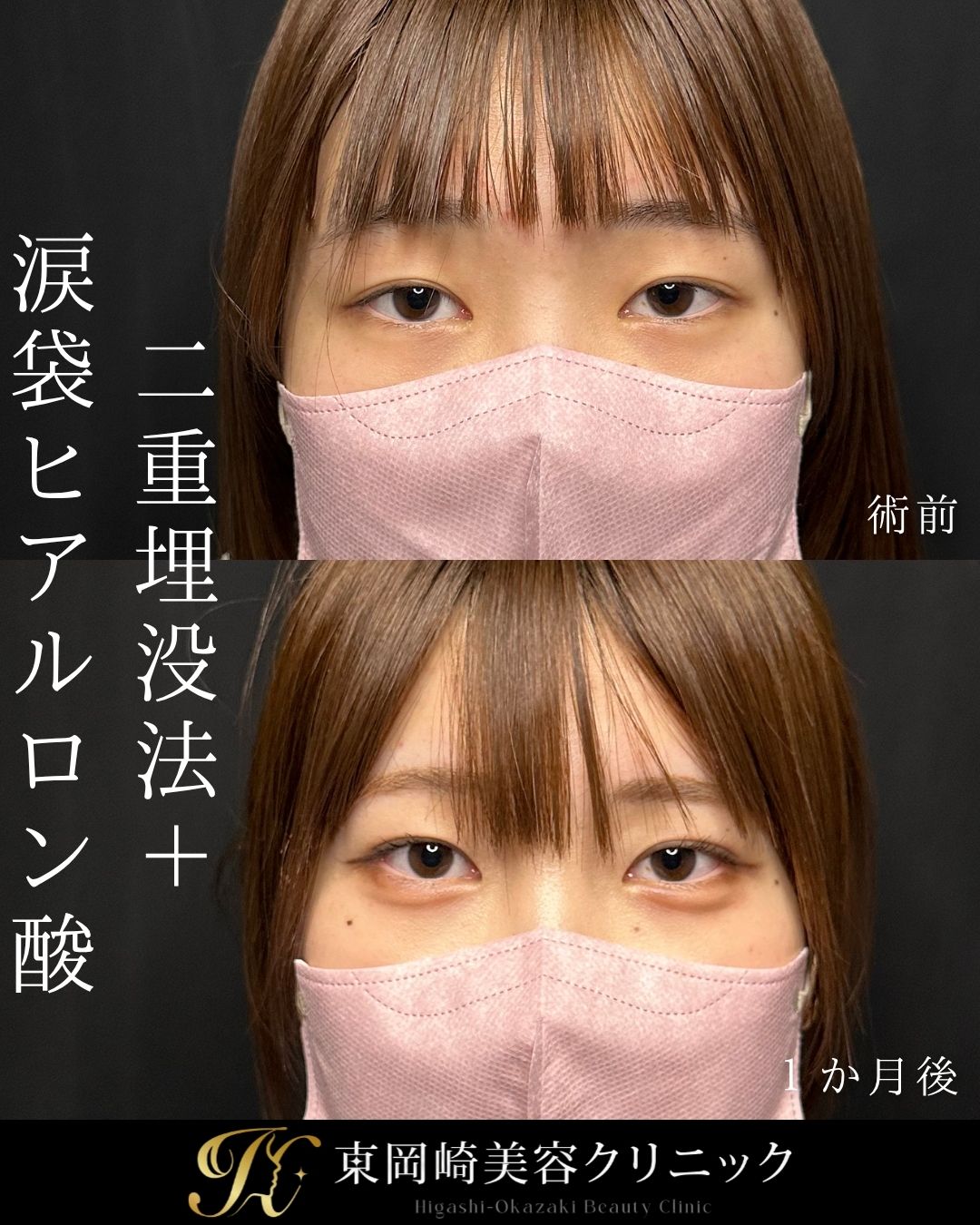 症例イメージ