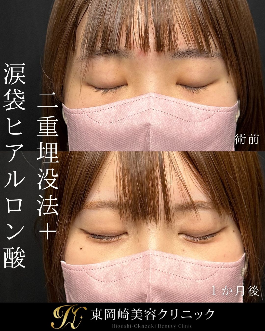 症例イメージ