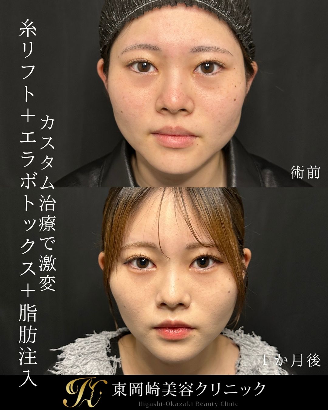 症例イメージ