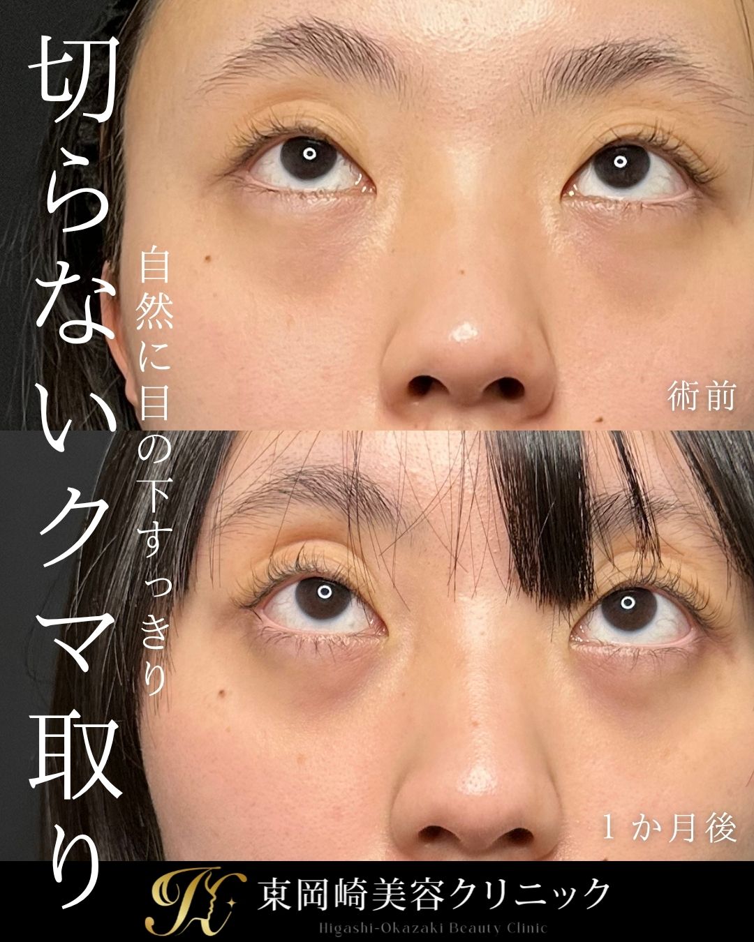 症例イメージ