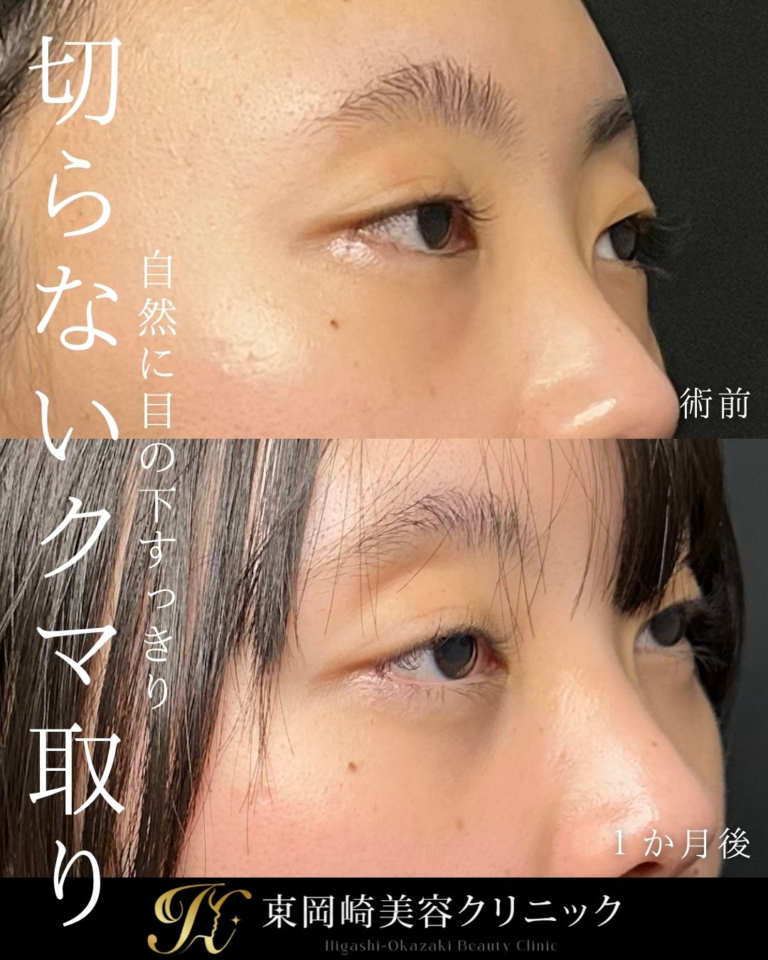症例イメージ