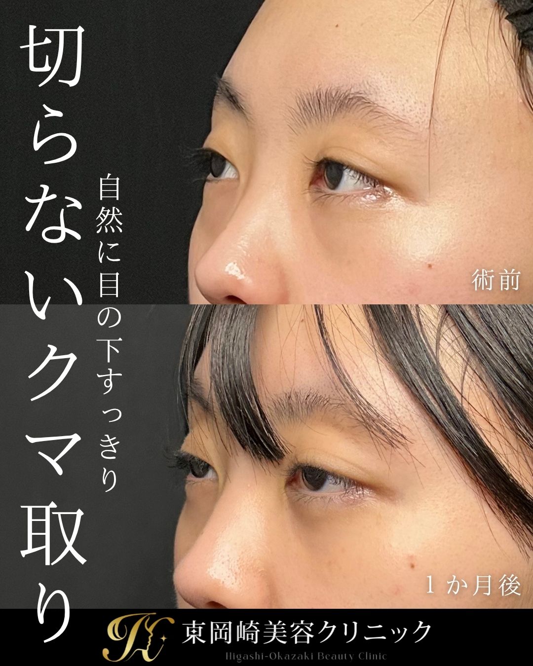 症例イメージ