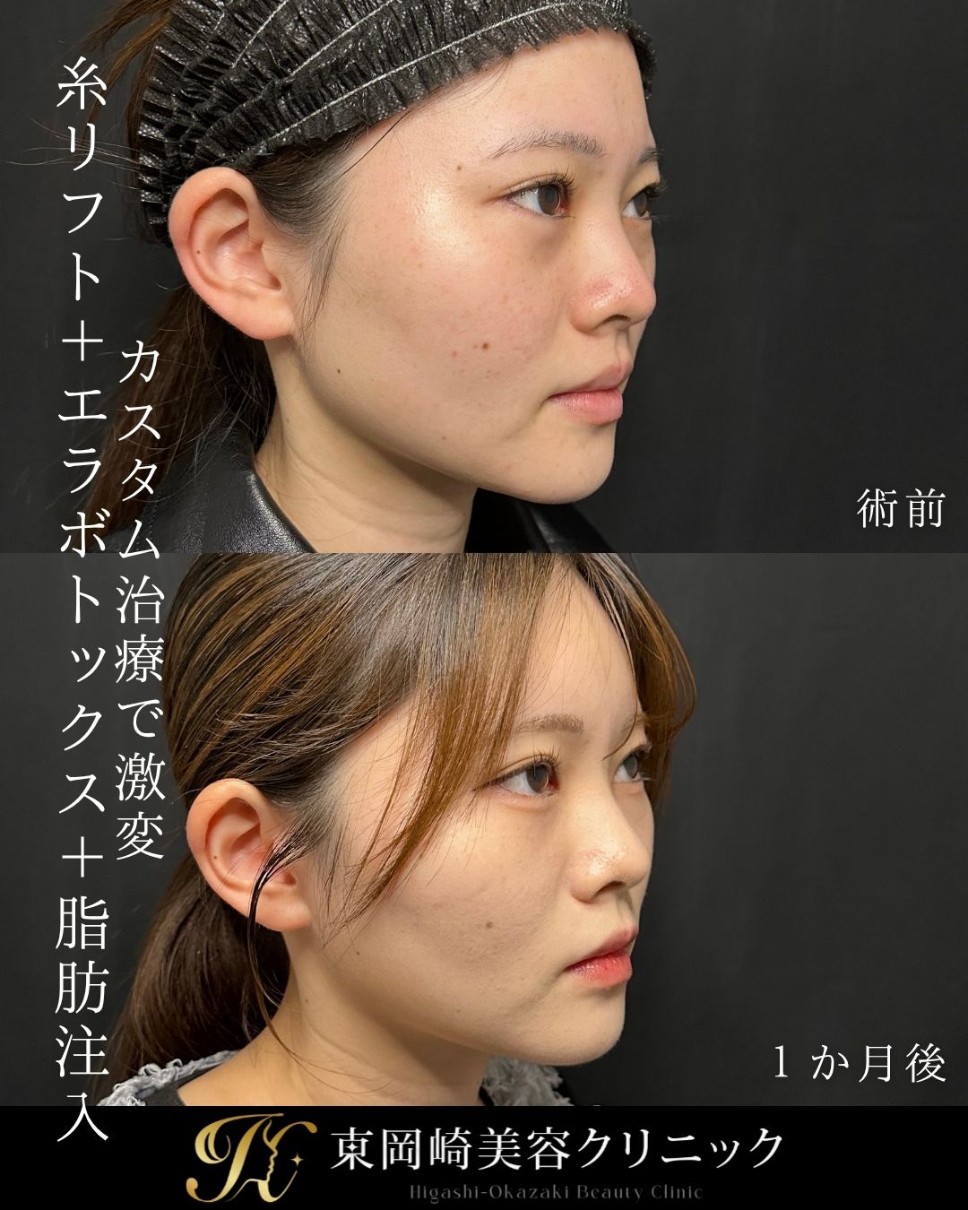 症例イメージ