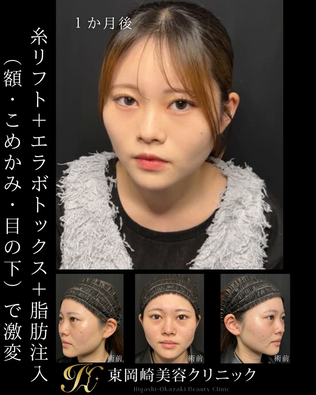症例イメージ