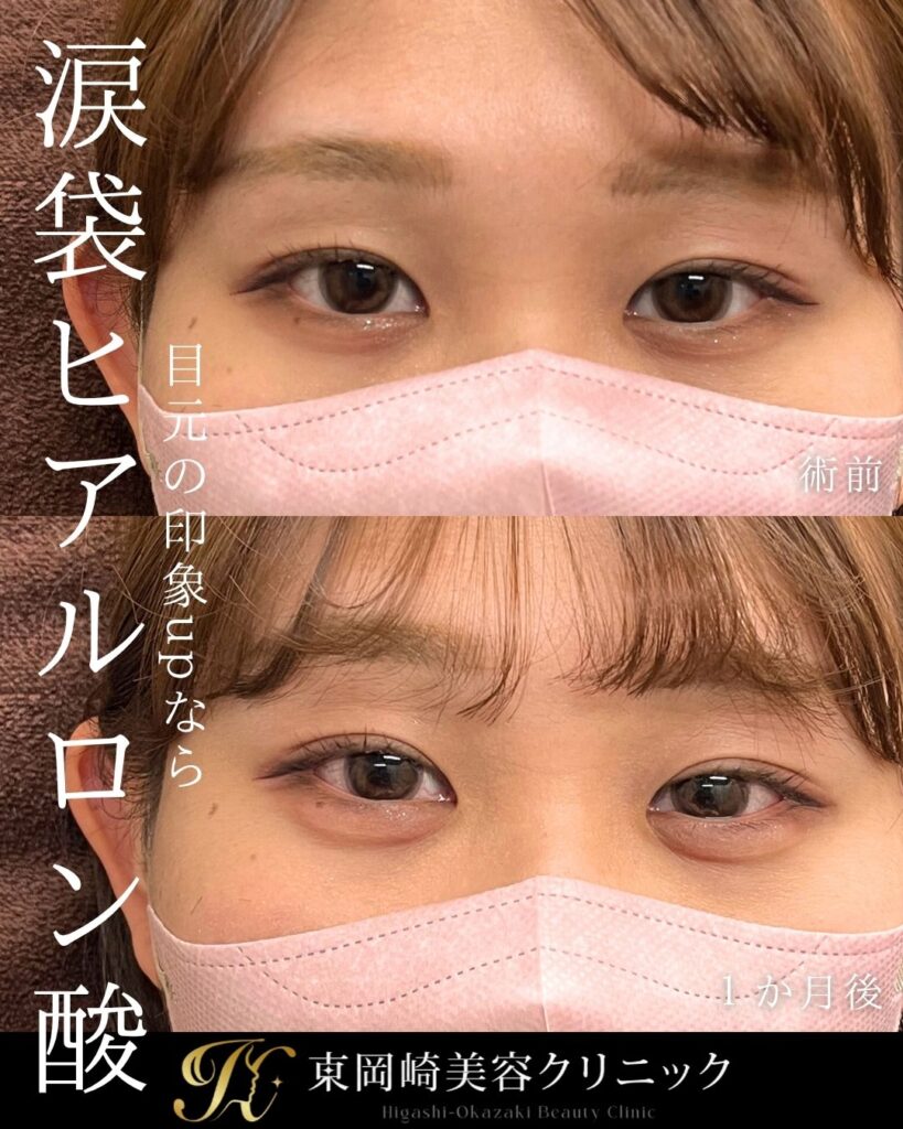 症例イメージ