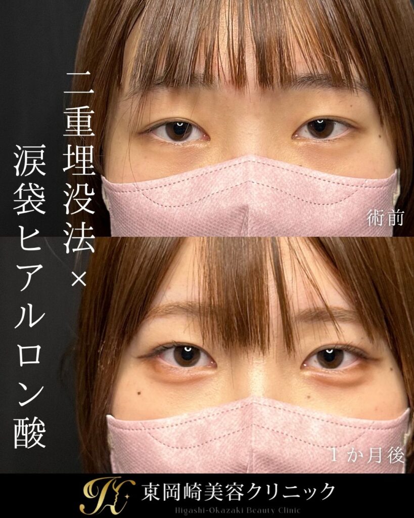 症例イメージ