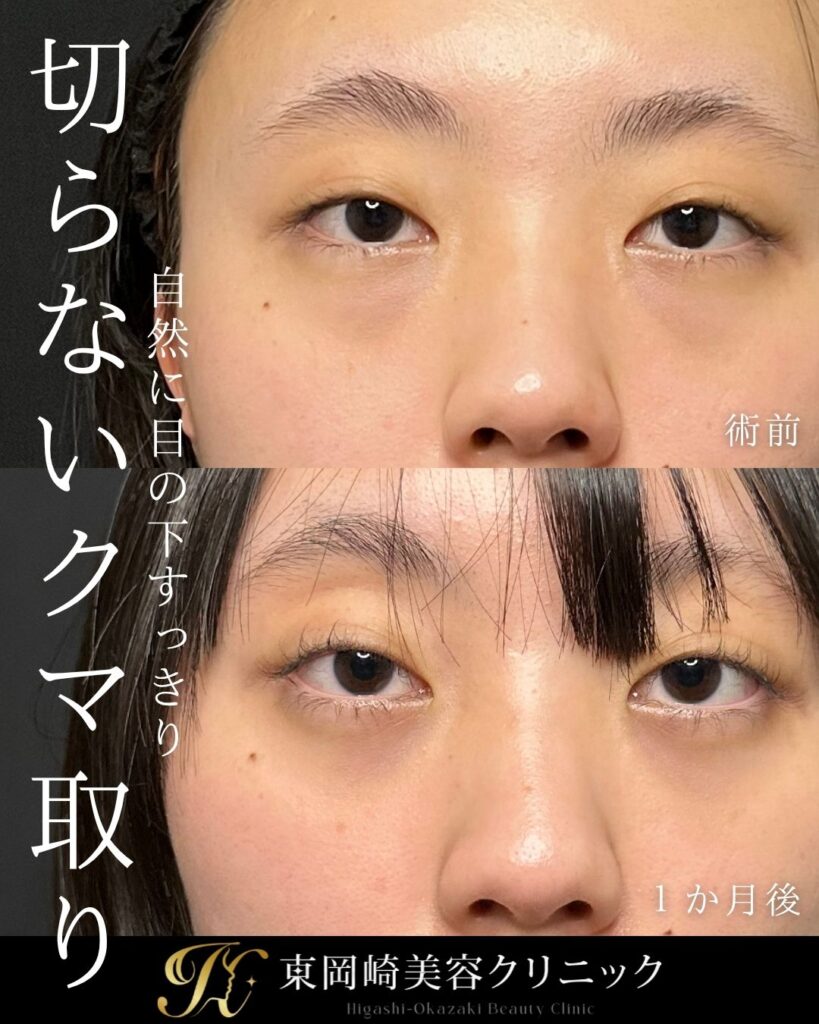 症例イメージ