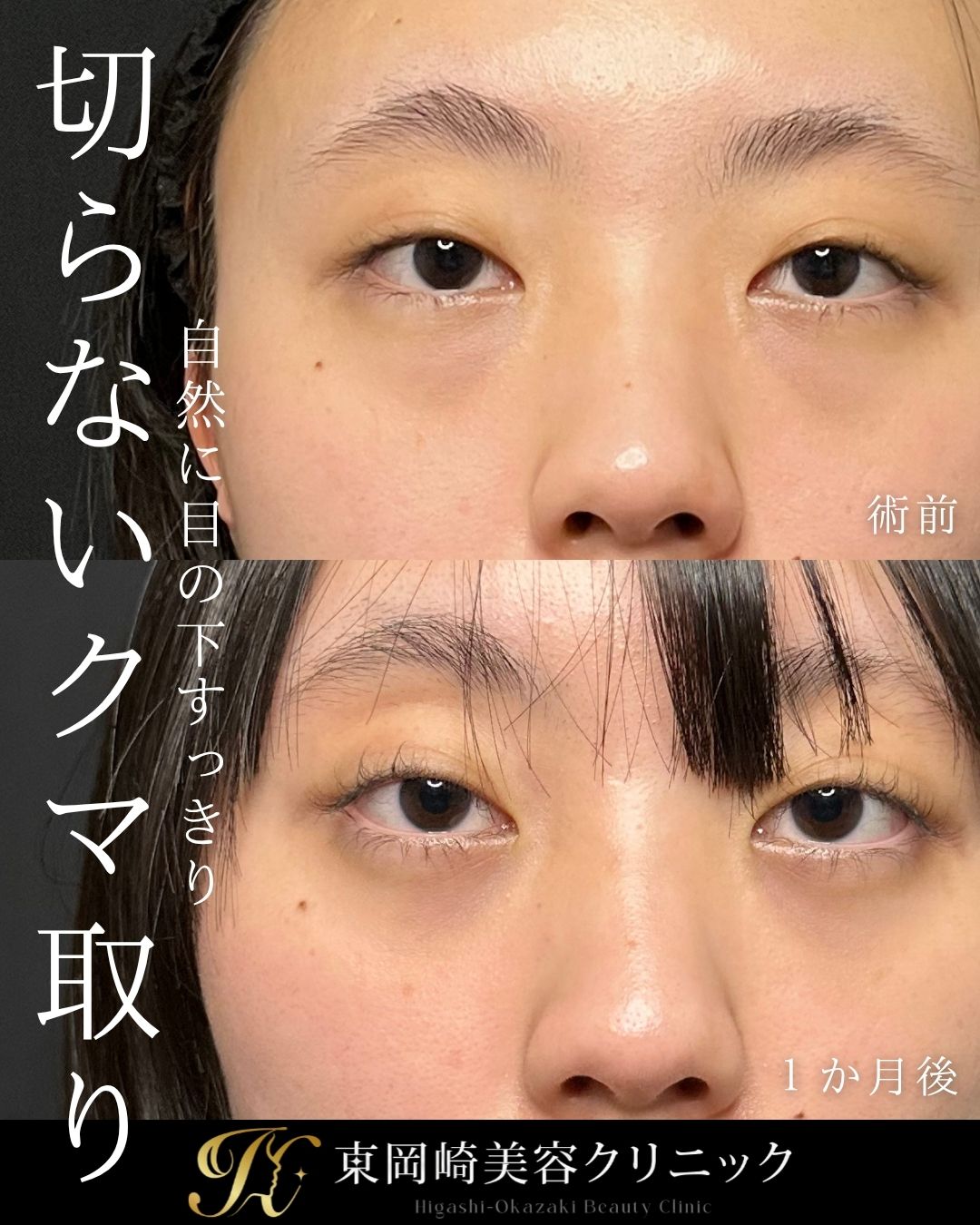 症例イメージ